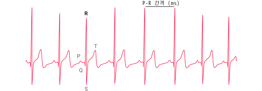 A graph showing a heart rate variability stress test.